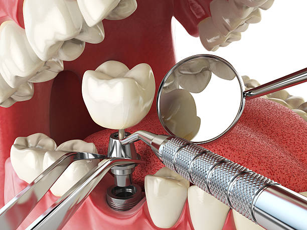 Best Cracked Tooth Emergency Dentist  in Mastic Beach, NY